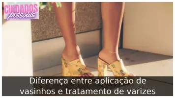 Diferença entre aplicação de vasinhos e tratamento de varizes